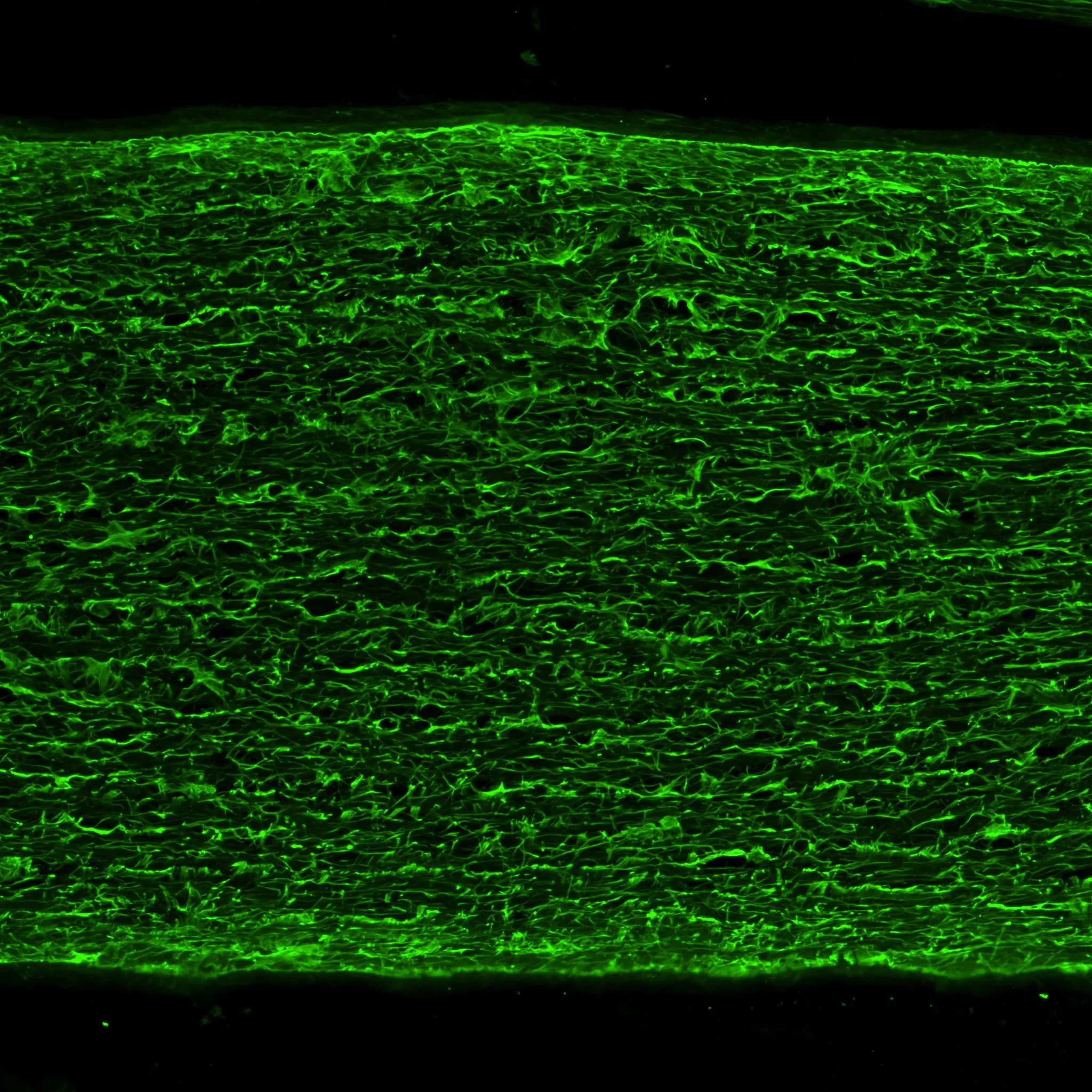 Confocal micrograph of a dense band of green glial fibres against a dark background
