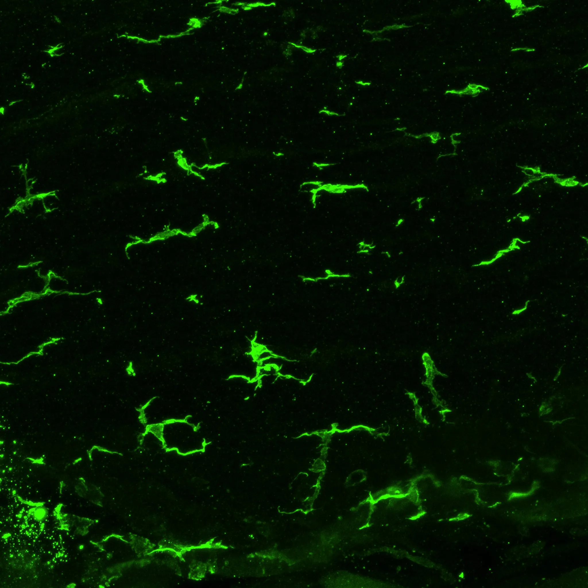 Confocal micrograph of microglia labelled in green scattered across dark brain tissue