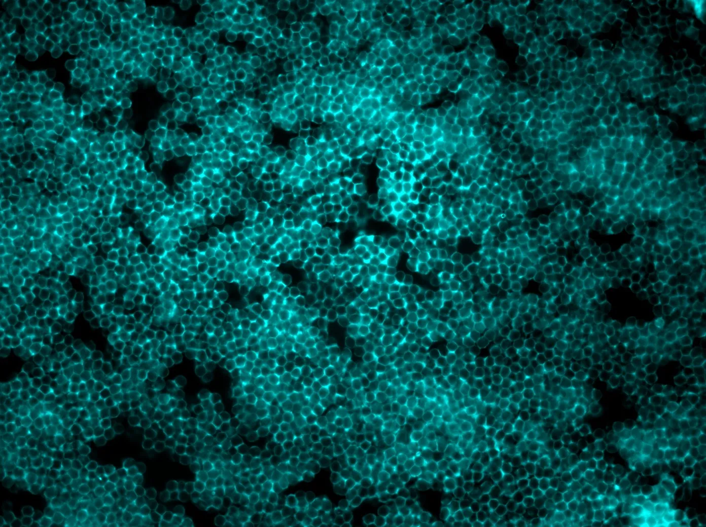 Fluorescence micrograph of retinal pigment epithelial cells forming a cyan cobblestone mosaic